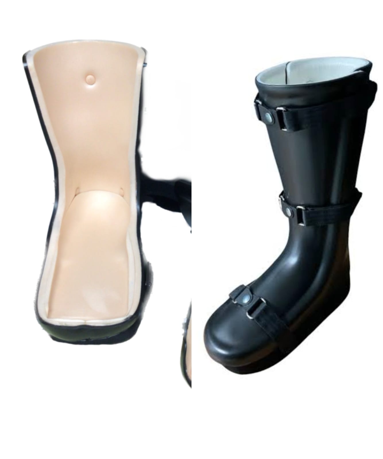 Custom-moulded diabetic foot orthotic designed to reduce pressure on vulnerable areas.